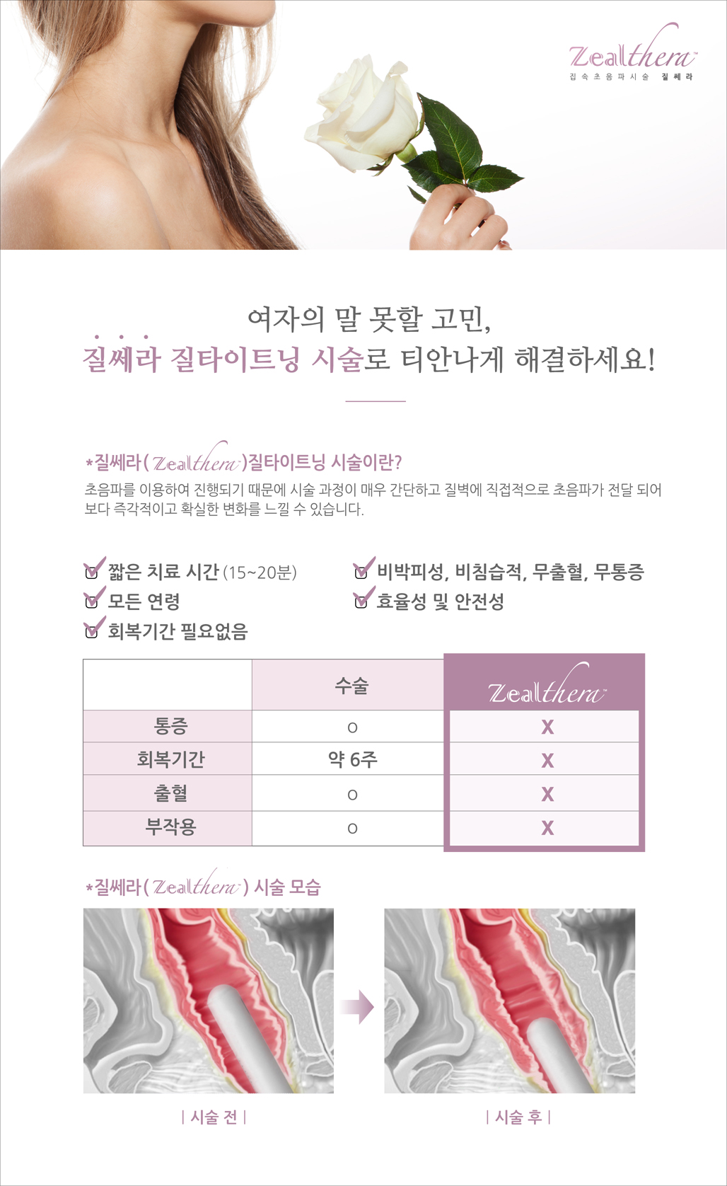 질쎄라